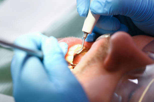 Best Pediatric Emergency Dentist in Maplewood, MO