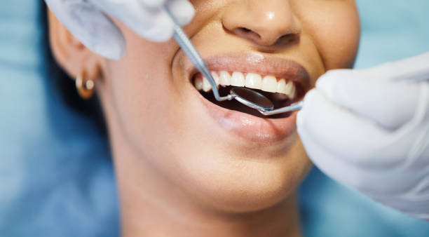 Best Emergency Dental Services for Seniors in Maplewood, MO